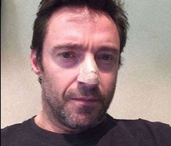 hugh-jackman