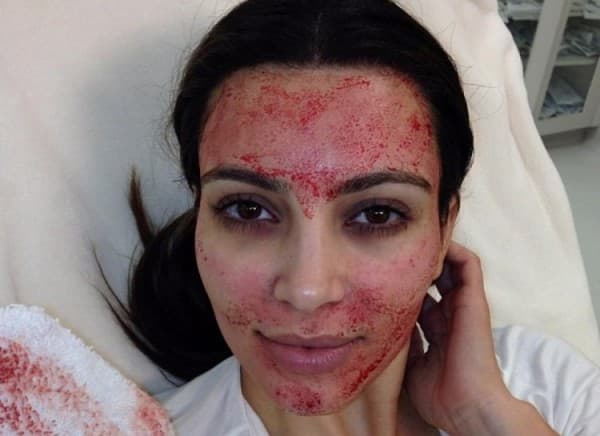 Kim u vampir-epizodi ( foto: Suggest )