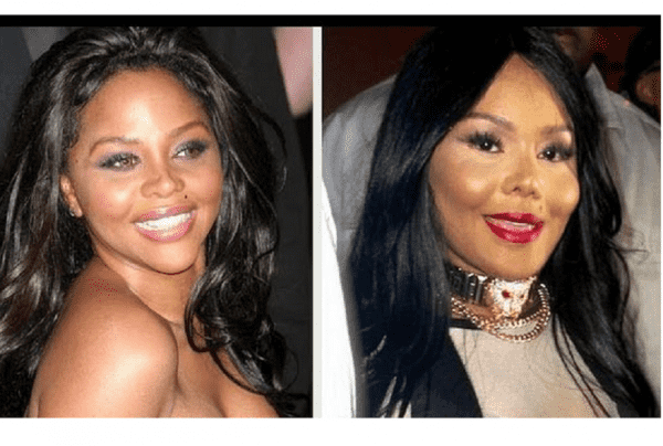 Lil' Kim ( foto: The Celebrity Surgery )